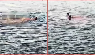 Krvavo more oko napadnute žene