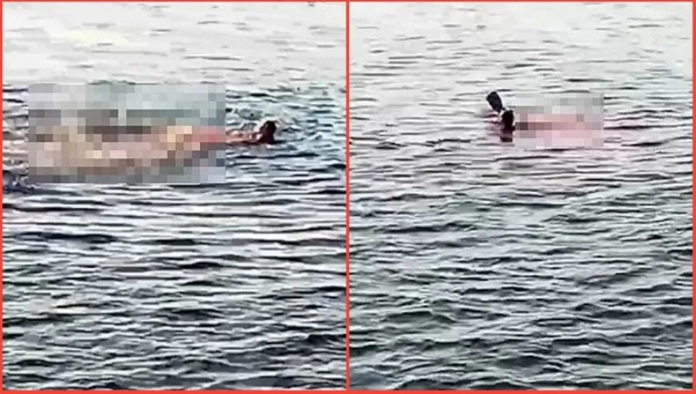 Krvavo more oko napadnute žene