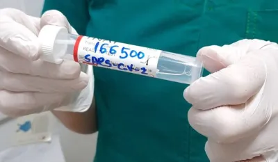 Вирус и даље хара регионом