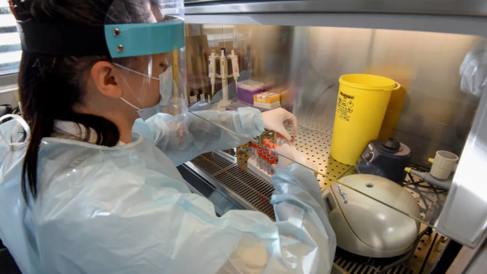 Jo&scaron; 178 novih slučajeva korone