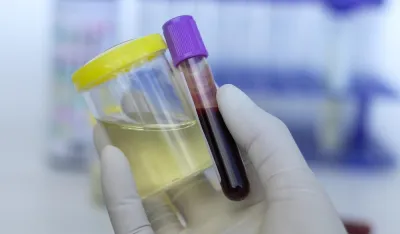 Antidoping test