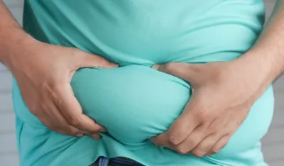 Načini da se izborite s vi&scaron;kom kilograma