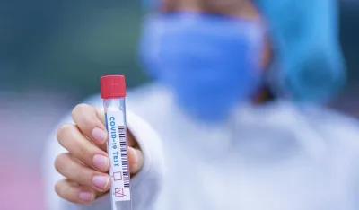 Тестови на ковид-19