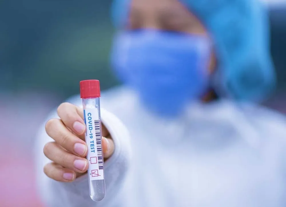 Тестови на ковид-19