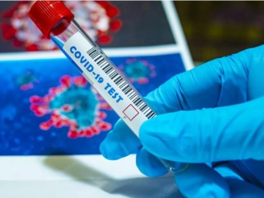 U Hrvatskoj preminulo pet osoba, 44 nova slučaja korone