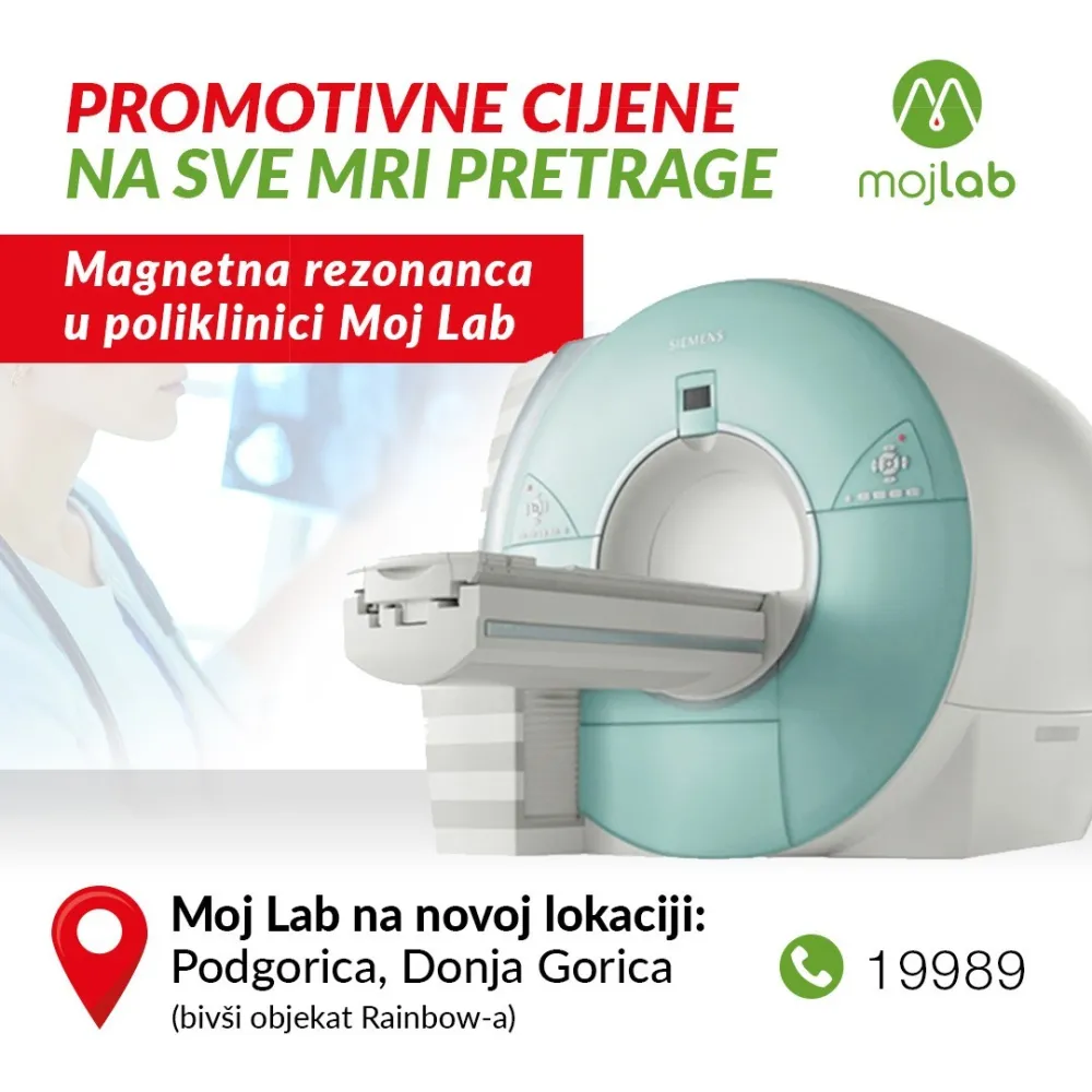 Moj Lab - promotivne cijene na sve MRI pretrage