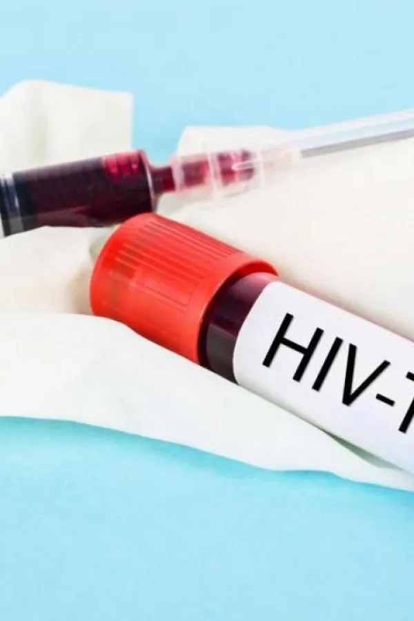 Опасност од ширења ХИВ-а