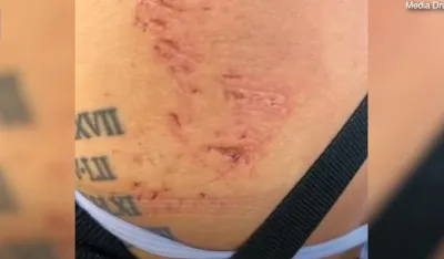 Ujed ajkule, Ilustracija