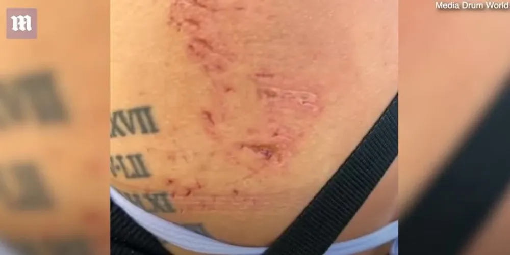 Ujed ajkule, Ilustracija