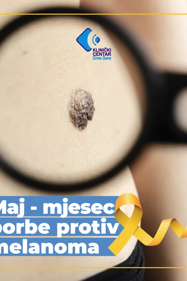 Maj &ndash; mjesec borbe protiv melanoma