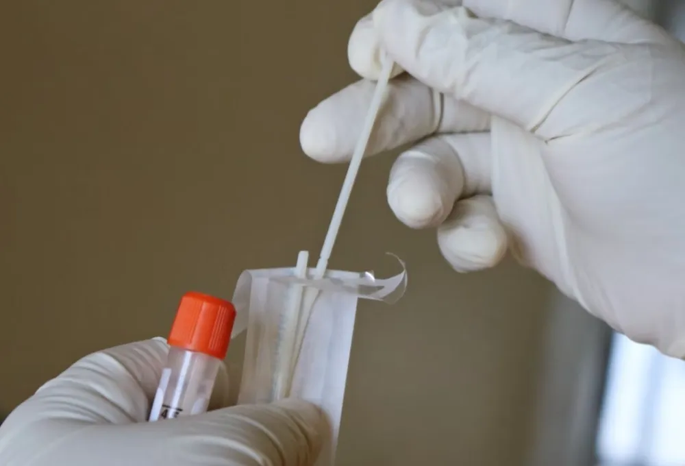 Srbija: Nema preminulih, jo&scaron; 266 pozitivnih na koronu