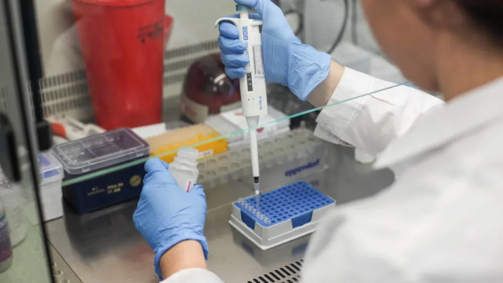 Tokom vikenda registrovana 22 nova slučaja infekcije