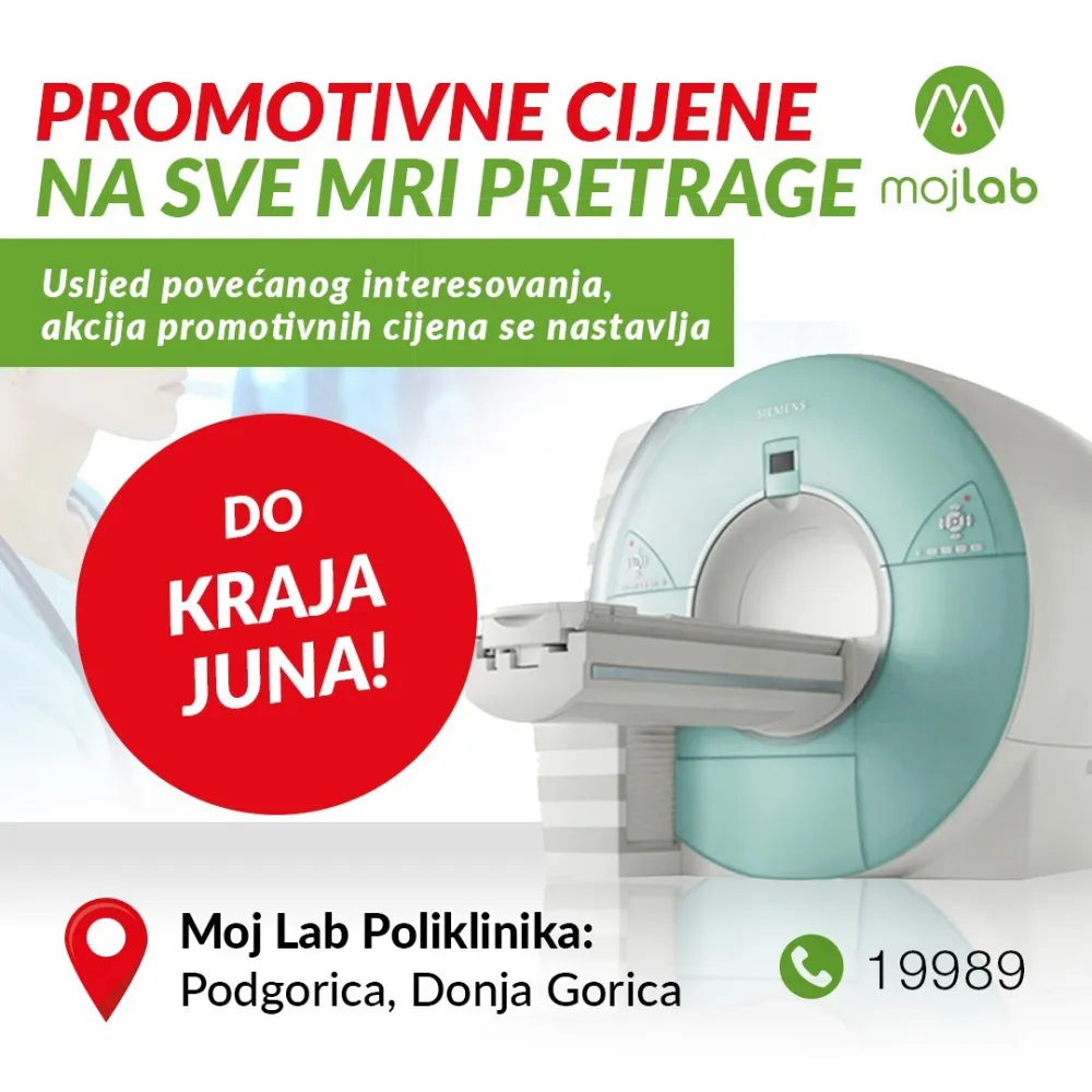 Promotivne cijene na sve MRI pretrage