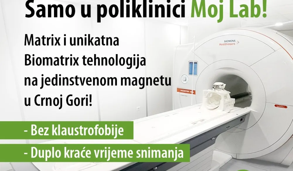 Matrix i Bio Matrix tehnologija