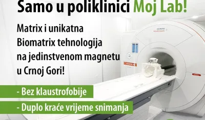 Matrix i Bio Matrix tehnologija