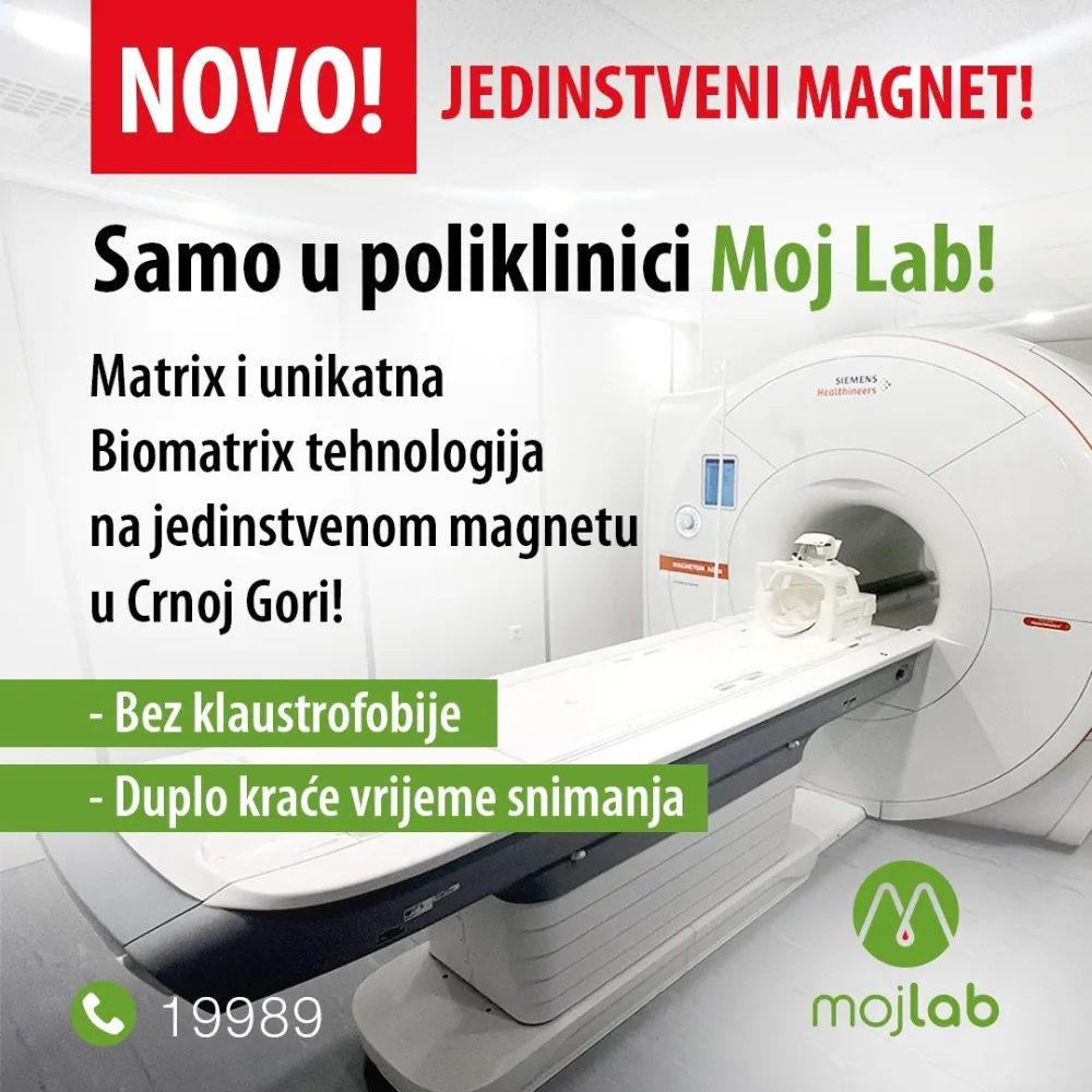 Matrix i Bio Matrix tehnologija
