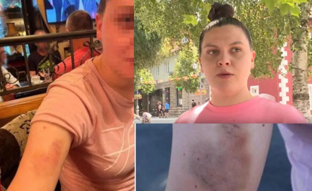 Policaјci pod lupom zbog postupanja prema Kola&scaron;inki