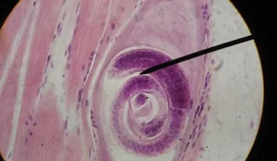 Trihinela ilustracija