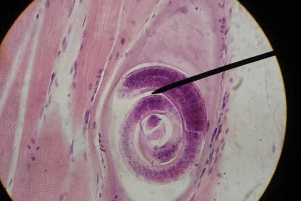 Trihinela ilustracija