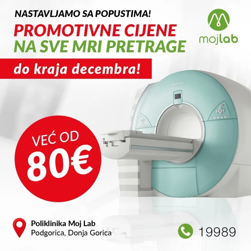 Promotivne cijene na sve MRI pretrage