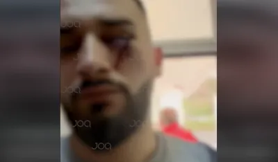 DUA: Albanske državljane maltretirale osobe u vojnim uniformama