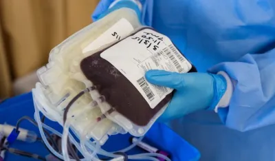 Pozvali građane sa nultom pozitivnom i A negativnom krvnom grupom da daju krv