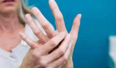 Simptomi se javljaju jo&scaron; u dvadesetim