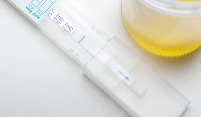 Ilustracija<br>test na drogu