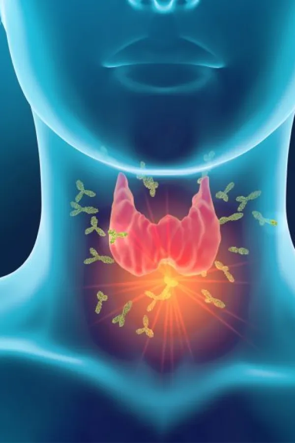 Najgora hrana za &scaron;titnu