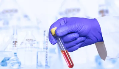 Proteini u krvi mogu predvidjeti ko će oboljeti od demencije