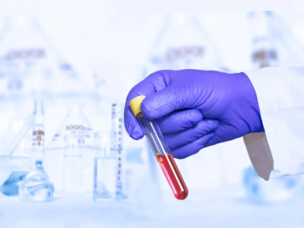 Proteini u krvi mogu predvidjeti ko će oboljeti od demencije