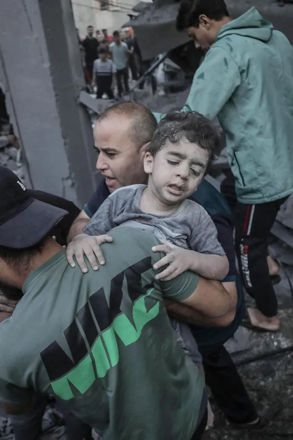(VIDEO) Humanitarna katastrofa u Gazi: Sve vi&scaron;e umrlih od gladi i dehidratacije