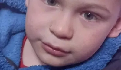 Pomozite sedmogodi&scaron;njem Ognjenu da ode na liječenje u Tursku