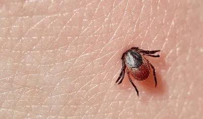 Počinje sezona krpelja: Kako ga pravilno izvući iz kože