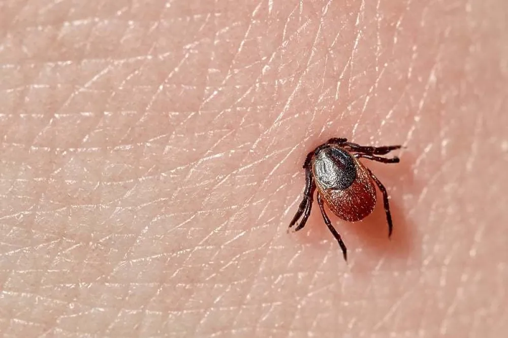 Počinje sezona krpelja: Kako ga pravilno izvući iz kože