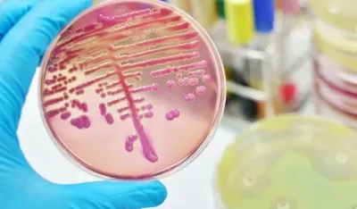 Razvijen novi način uni&scaron;tavanja bakterija otpornih na antibiotike