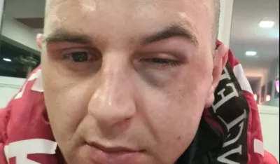 Crnogorski tiktoker tvrdi da je pretučen u Plavu