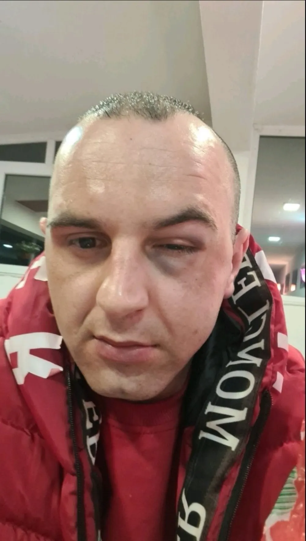 Crnogorski tiktoker tvrdi da je pretučen u Plavu