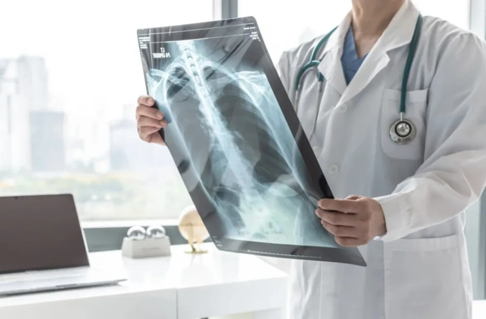 Počelo testiranje prve vakcine protiv raka pluća