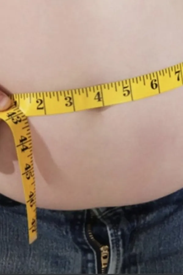 Prejedanje i gojaznost mogu biti izazvani specifičnim bakterijama u crijevima