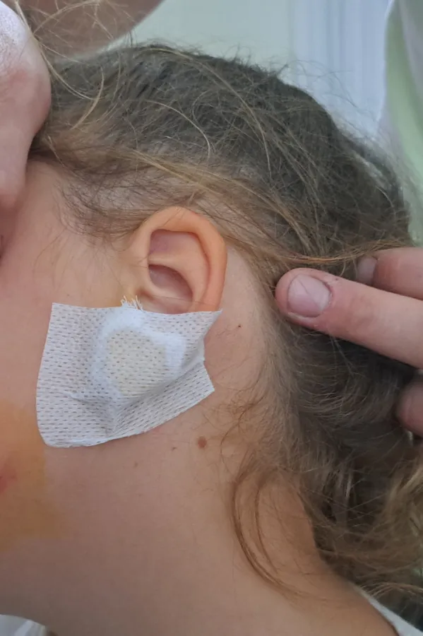 (FOTO) Nik&scaron;ić: Čopor pasa lutalica napao i ugrizao za lice &scaron;estogodi&scaron;nje dijete
