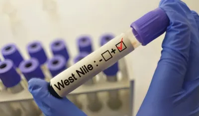 U Srbiji registrovana 62 slučaja groznice Zapadnog Nila