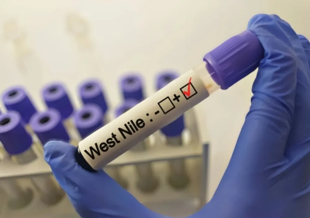 U Srbiji registrovana 62 slučaja groznice Zapadnog Nila
