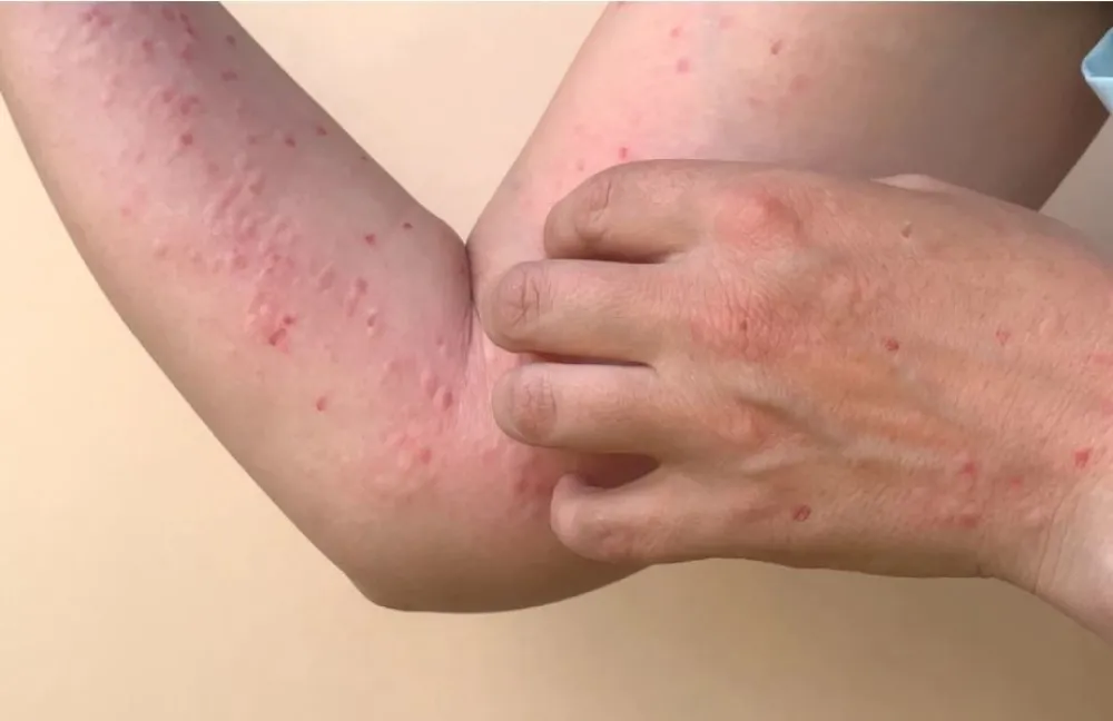 Majmunske boginje, ilustracija