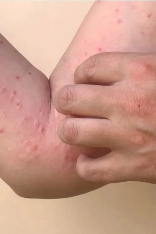 Majmunske boginje, ilustracija