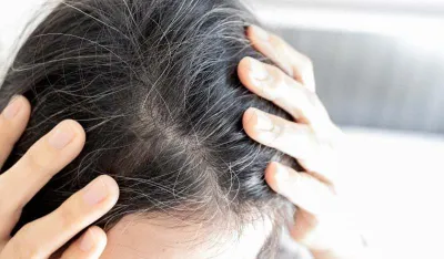 Umor i sijede vlasi mogu biti nedostatak važnog nutrijenta