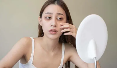 &Scaron;ta va&scaron;i podočnjaci govore o va&scaron;em zdravlju? Ovo su signali koje ne smijete ignorisati