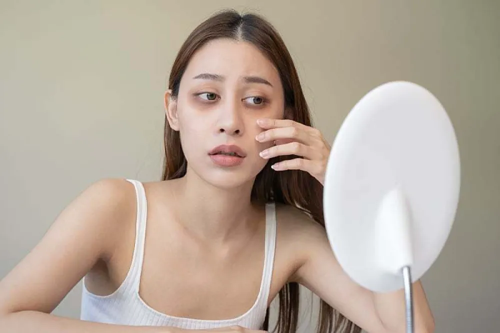 &Scaron;ta va&scaron;i podočnjaci govore o va&scaron;em zdravlju? Ovo su signali koje ne smijete ignorisati