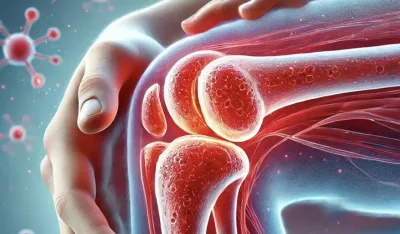 Reuma napada i mlađe ljude: Prepoznajte simptome