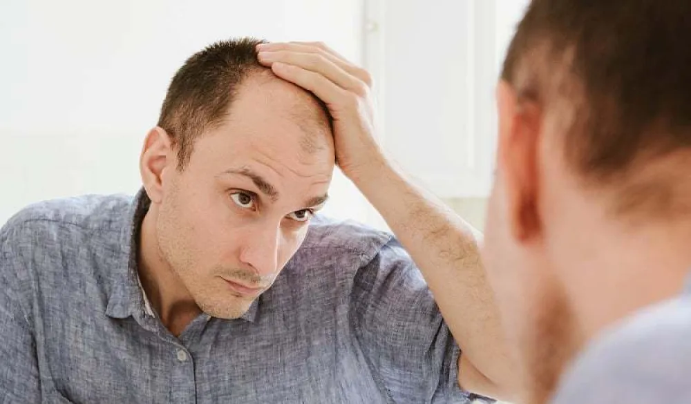 Opada vam kosa? Isprobajte test koji otkriva u čemu je tačno problem
